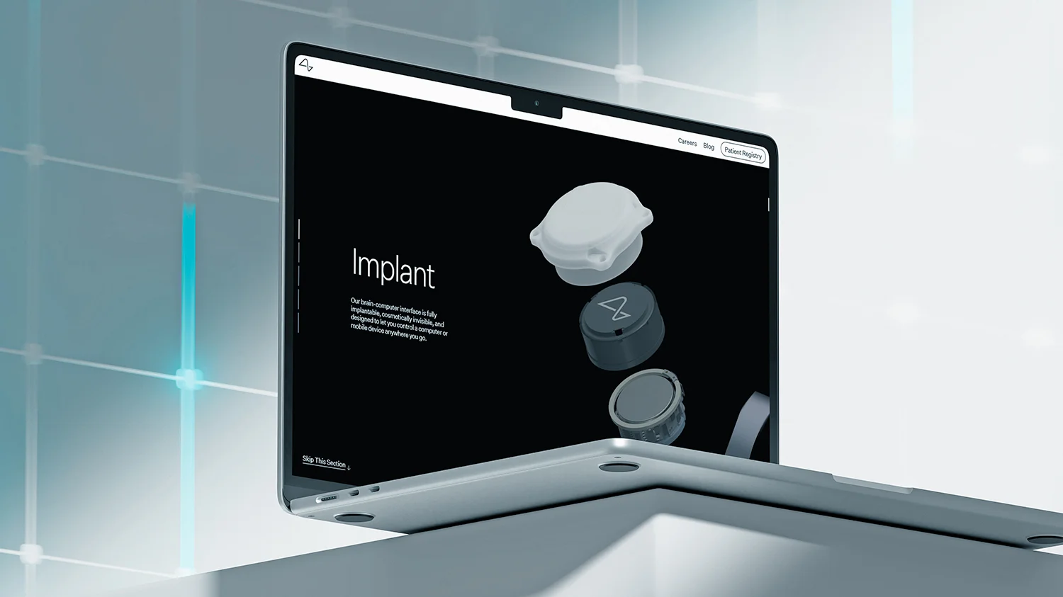 Otwarty laptop wyświetlający stronę internetową z grafiką i opisem implantu mózgowego typu BCI (brain-computer interface) na czarnym tle.